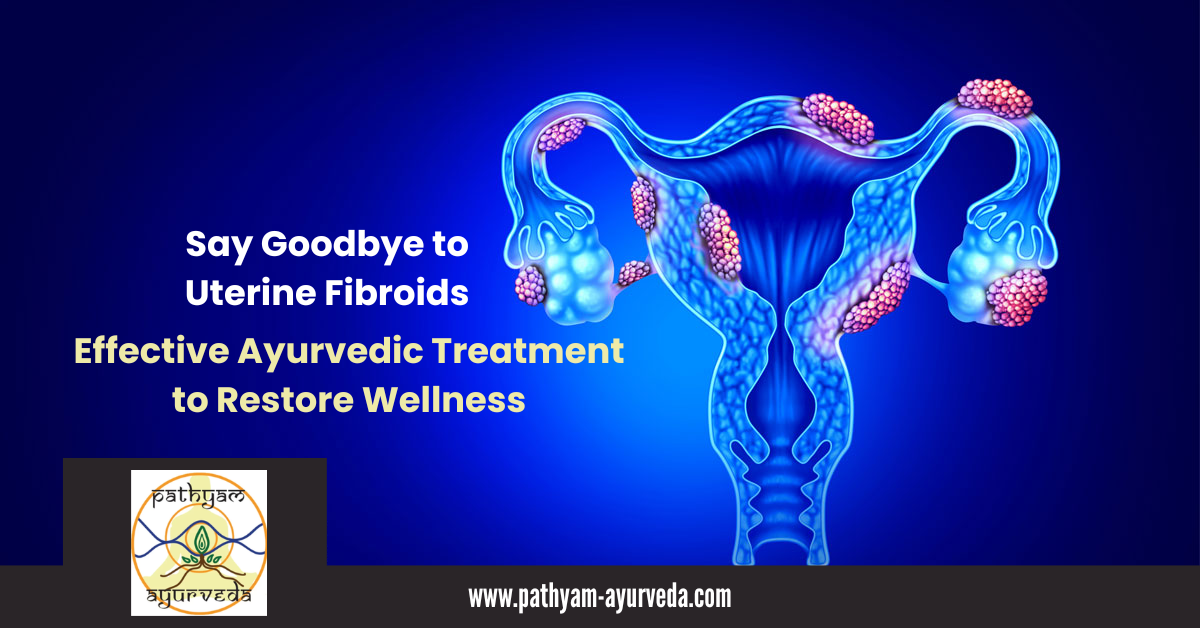 Say Goodbye to Uterine Fibroids: Effective Ayurvedic Treatment to Restore Wellness