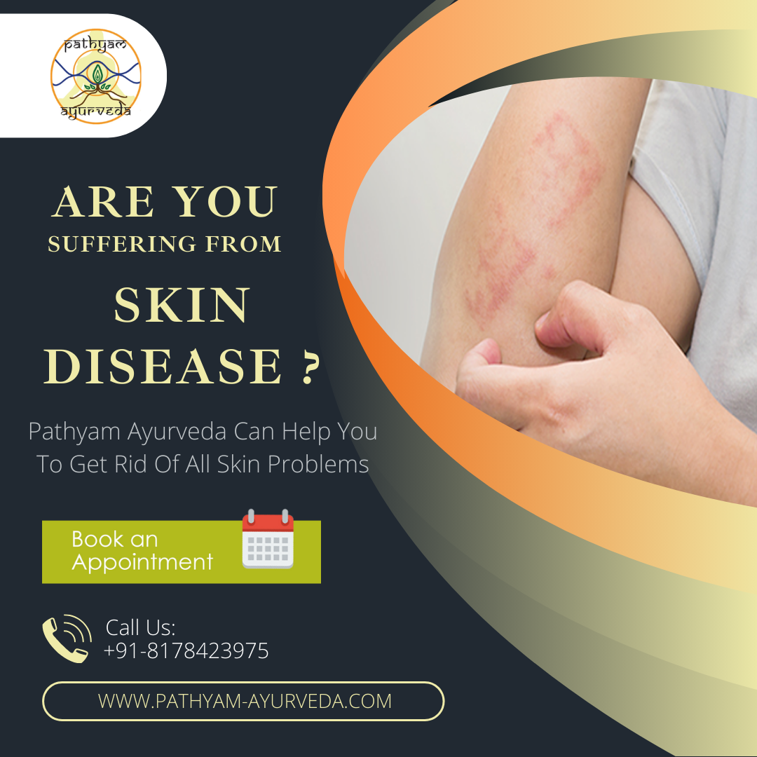 Are You Suffering from Skin Diseases?