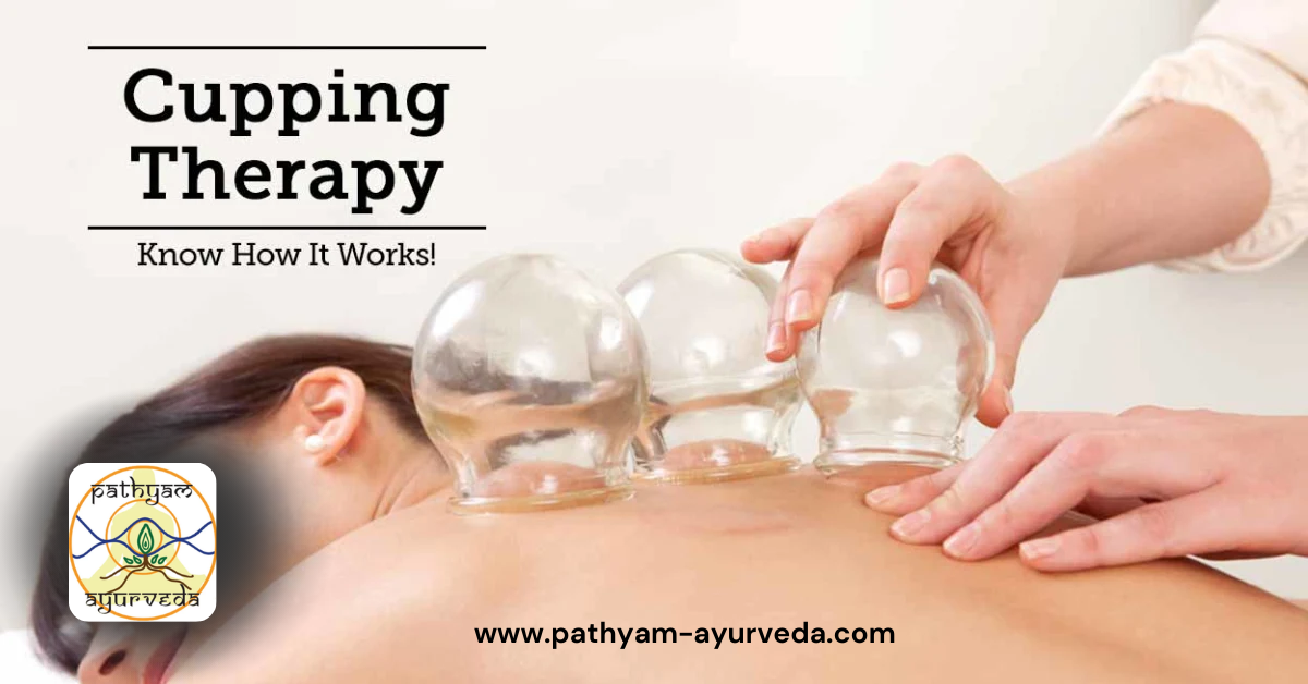 What is Cupping Therapy in Ayurveda?