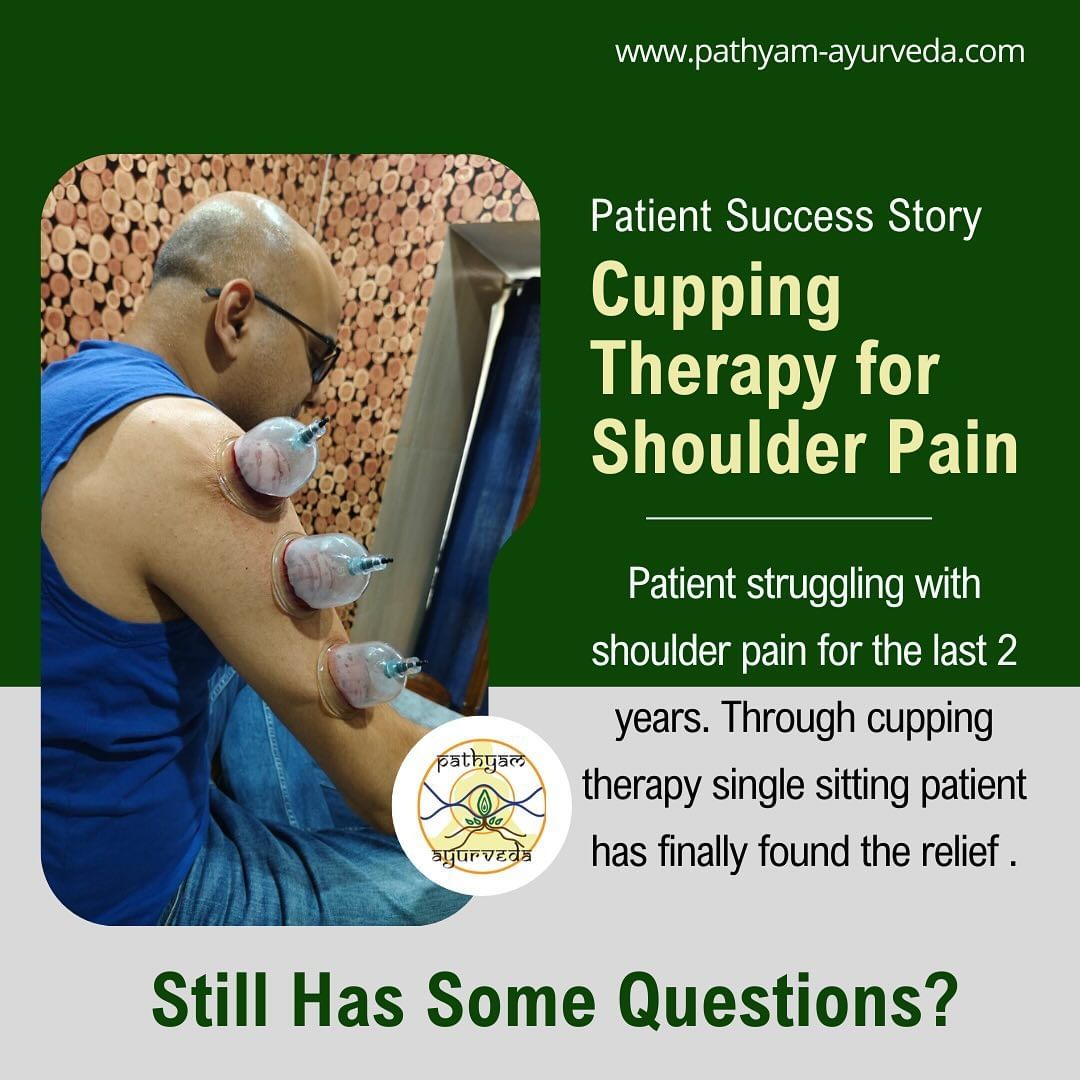 Cupping Therapy for Shoulder Pain